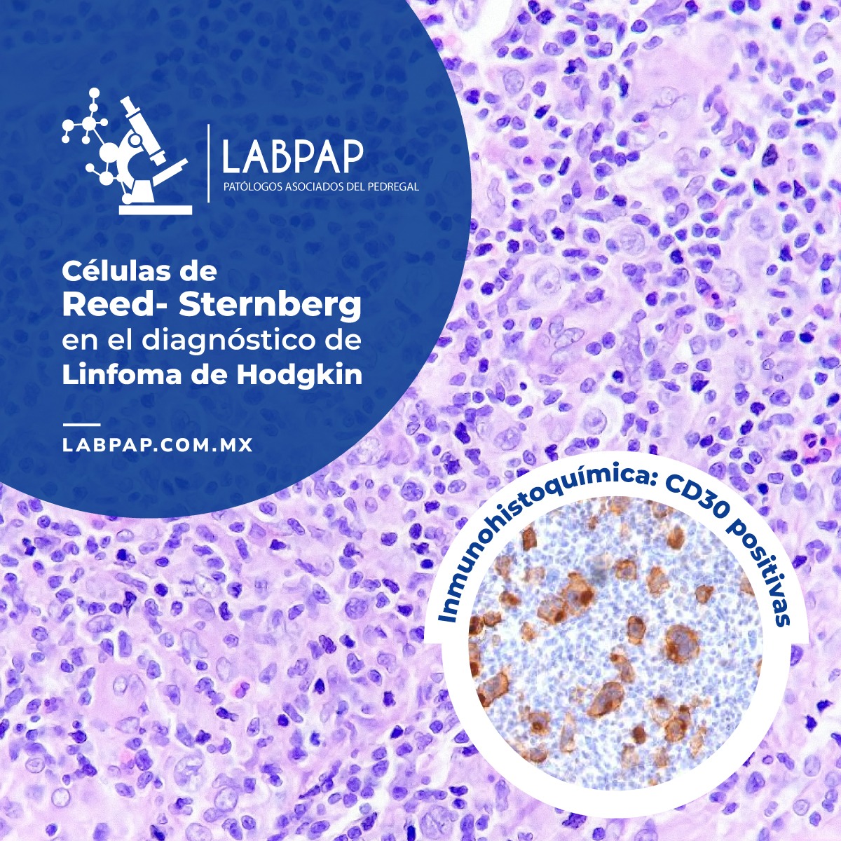 Inmunohistoquímica LABPAP