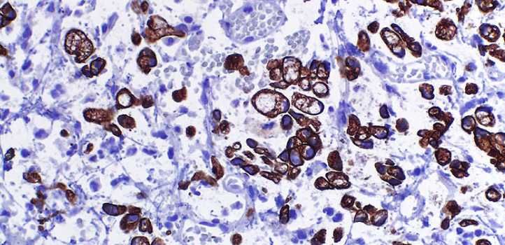 Qué es la inmunohistoquímica - LABPAP