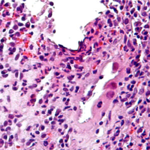 imagen de marcadores de una inmunohistoquímica - LABPAP