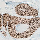 Estudio de Inmunohistoquímica