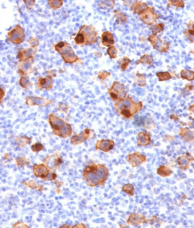 Inmunohistoquímica - LABPAP