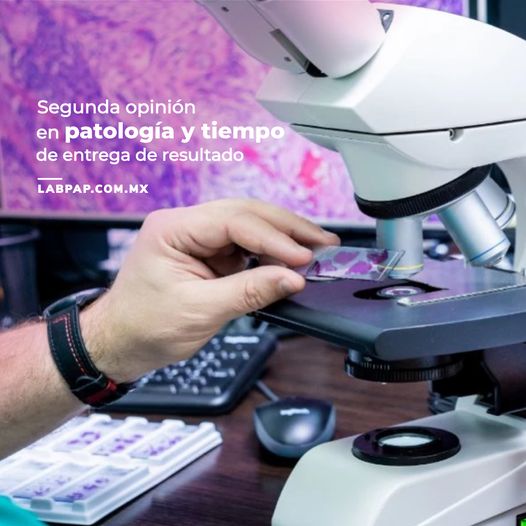 Segunda opinión de un resultado de patología Segunda opinión de un resultado de patologí